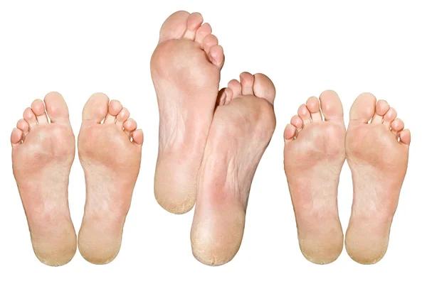 The Benefits of Choosing Ideal Feet of San Antonio for Your Foot Care Needs